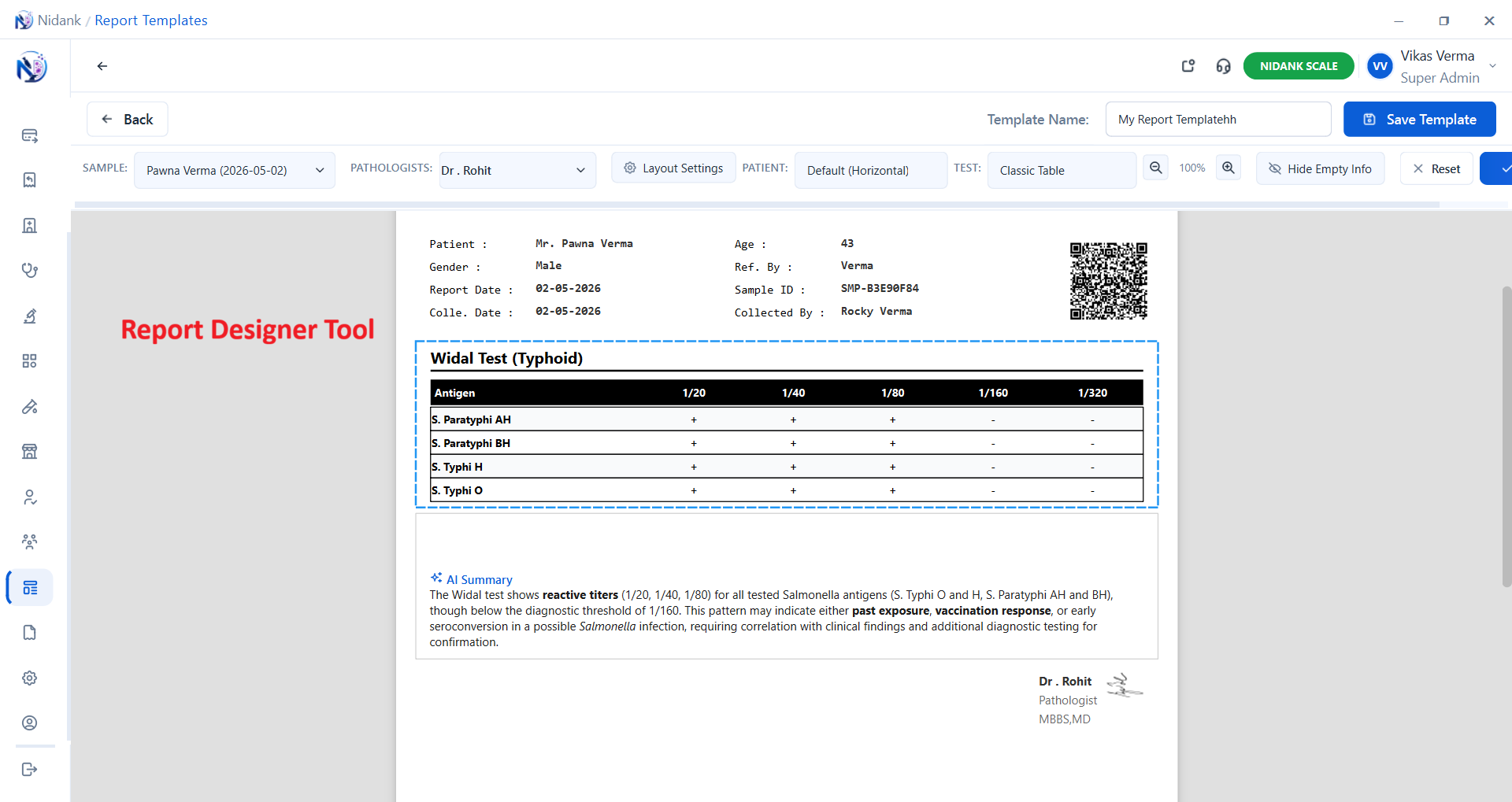 Software Preview 4